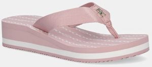 Šľapky Tommy Hilfiger IM TH CHAINPRINT MIDWEDGE SANDAL dámske, ružová farba, na kline, FW0FW08527